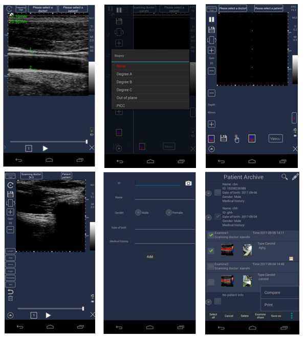 CScan® Android Ultrasound Scanner