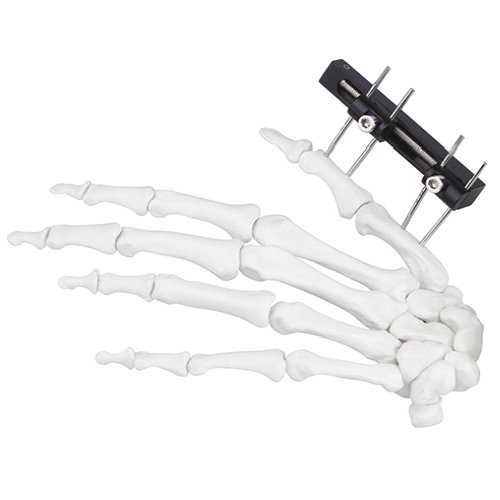 Mini Fragment External Fixator (Finger and Palm)