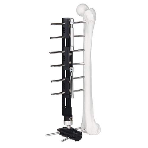 Bone Lengthening External Fixator - Type C
