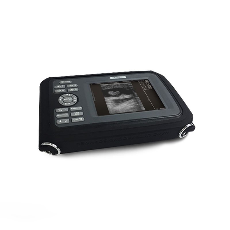 Medical Device Diagnostic Portable Digital Ultrasound Scanner SONO R