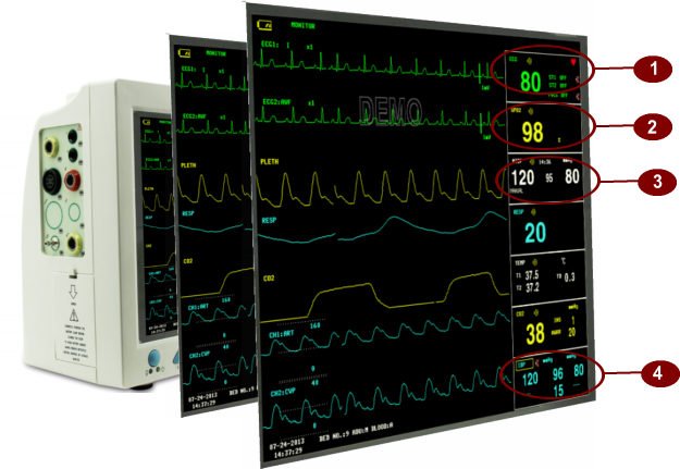 MD9000s Patient Monitor 12 Inch Color TFT Screen