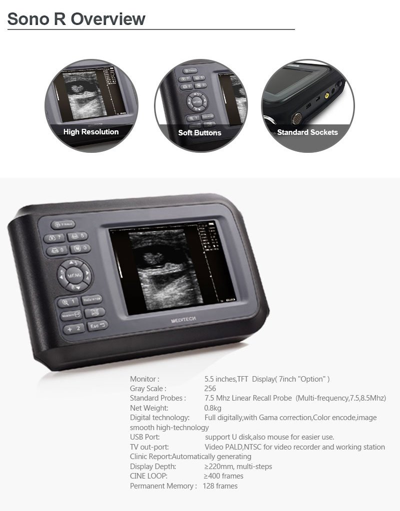 Medical Device Diagnostic Portable Digital Ultrasound Scanner SONO R