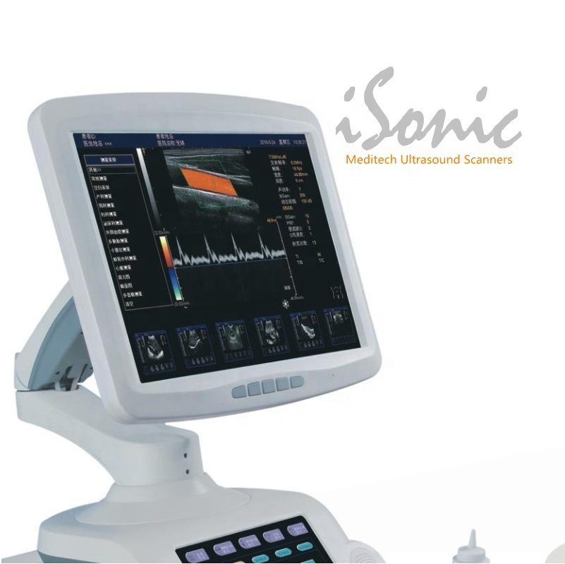 iSonic High Quality Images Color Ultrasound Scanner