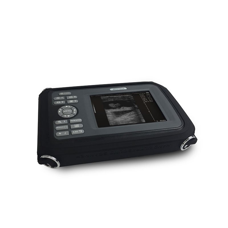 Medical Device Diagnostic Portable Digital Ultrasound Scanner SONO R