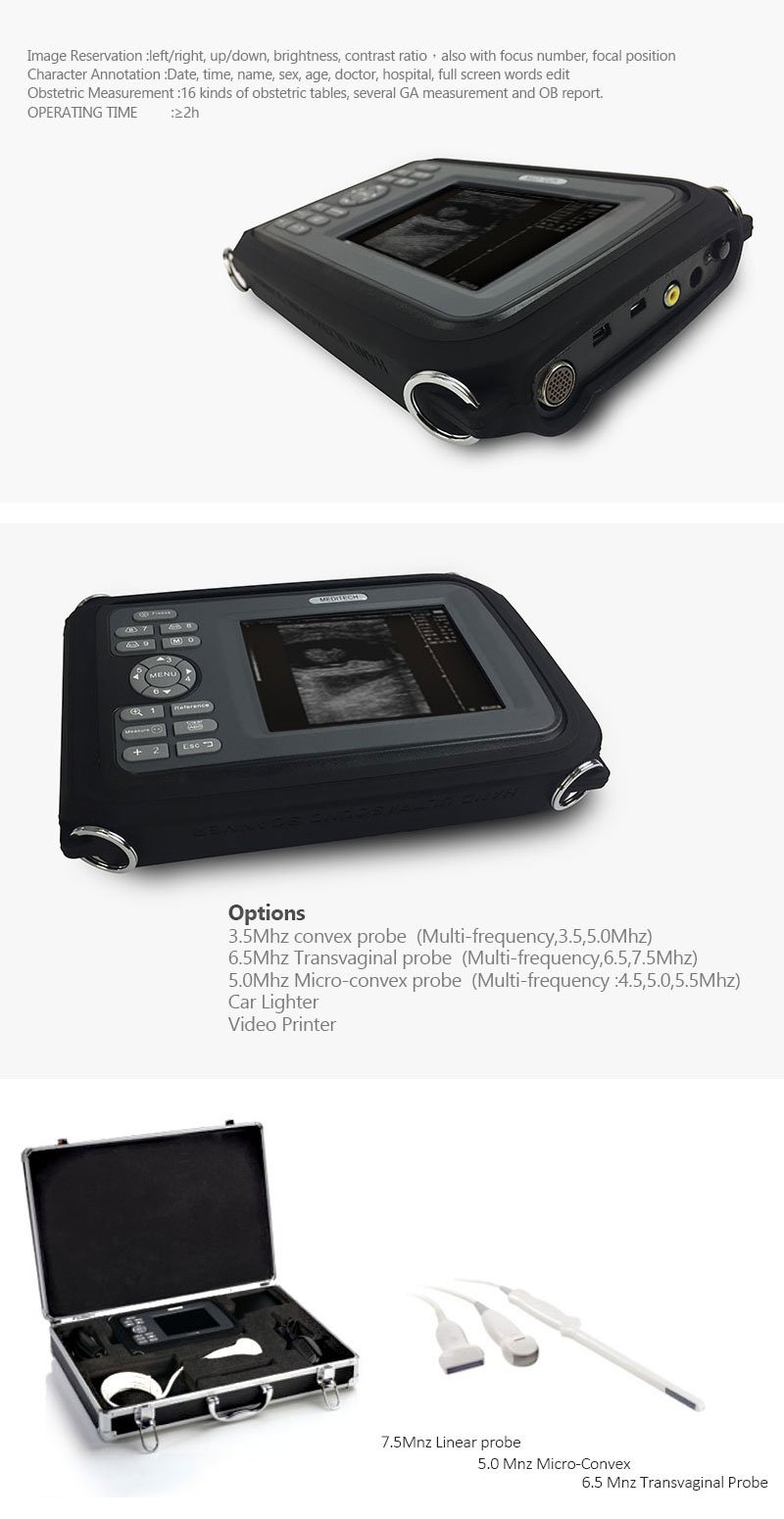 Medical Device Diagnostic Portable Digital Ultrasound Scanner SONO R