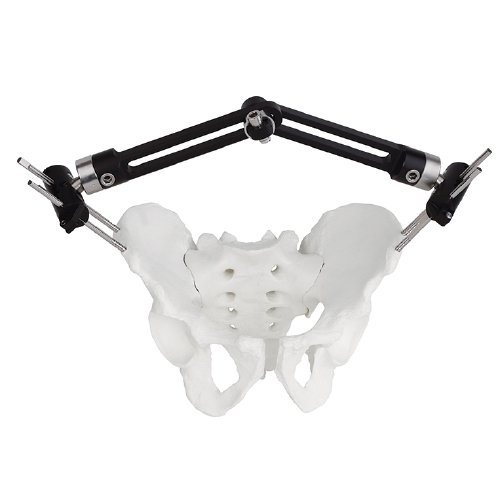 Pelvic Fragment External Fixator - Type B