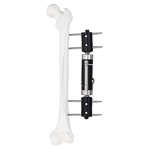 Straight Type External Fixator