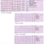 ECG Machine ECG6012-1|ECG Machine ECG6012-3|ECG Machine ECG6012-4|ECG Machine ECG6012-2|ECG Machine ECG6012-5|1-160H51431034F