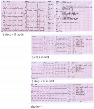 7 Inch TFT Touch Screen 3+1/6 Channel ECG Machine ECG6012