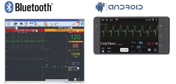 MD905 Patient Monitor Touch Screen 5.0 inch Color TFT Screen with Android App