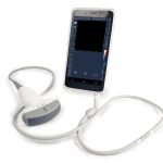 Smart Color Android Ultrasound Scanner|CScan® Android Ultrasound Scanner-4|CScan® Android Ultrasound Scanner-3|CScan® Android Ultrasound Scanner-2|CScan® Android Ultrasound Scanner-1|1-1G115203R5138|1-1P305223322941|1-1Z103121602A5|1-1G115202A9325|Smart Color Ultrasound Scanner-1|Smart Color Ultrasound Scanner-2|Smart Color Ultrasound Scanner-3