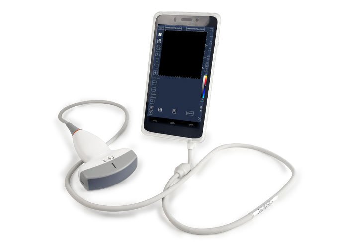 CScan® Android Ultrasound Scanner