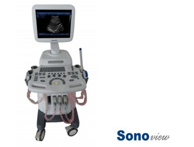 Sonoview® Full Digital Imaging Ultrasound Scanner