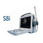 Medical Device S8i Color Portable Ultrasound Scanner-2|Medical Device S8i Color Portable Ultrasound Scanner-1|Medical Device S8i Color Portable Ultrasound Scanner-3|Medical Device S8i Color Portable Ultrasound Scanner-4|Medical Device S8i Color Portable Ultrasound Scanner-5|Medical Device S8i Color Portable Ultrasound Scanner-6
