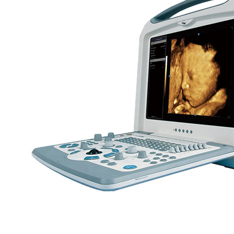 Medical Device S8i Color Portable Ultrasound Scanner