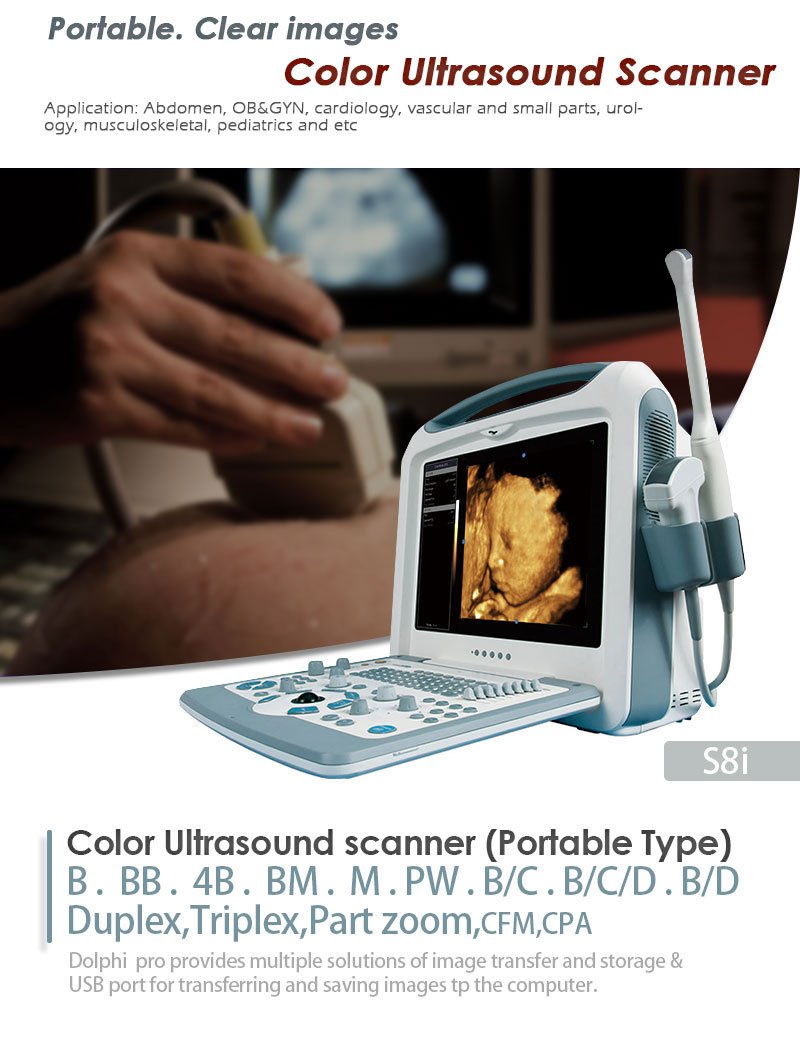 Medical Device S8i Color Portable Ultrasound Scanner