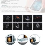 Medical Device S8i Color Portable Ultrasound Scanner-2|Medical Device S8i Color Portable Ultrasound Scanner-1|Medical Device S8i Color Portable Ultrasound Scanner-3|Medical Device S8i Color Portable Ultrasound Scanner-4|Medical Device S8i Color Portable Ultrasound Scanner-5|Medical Device S8i Color Portable Ultrasound Scanner-6