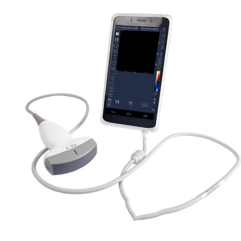 CScan® Ultrasound Scanner - Teds Medical Devices