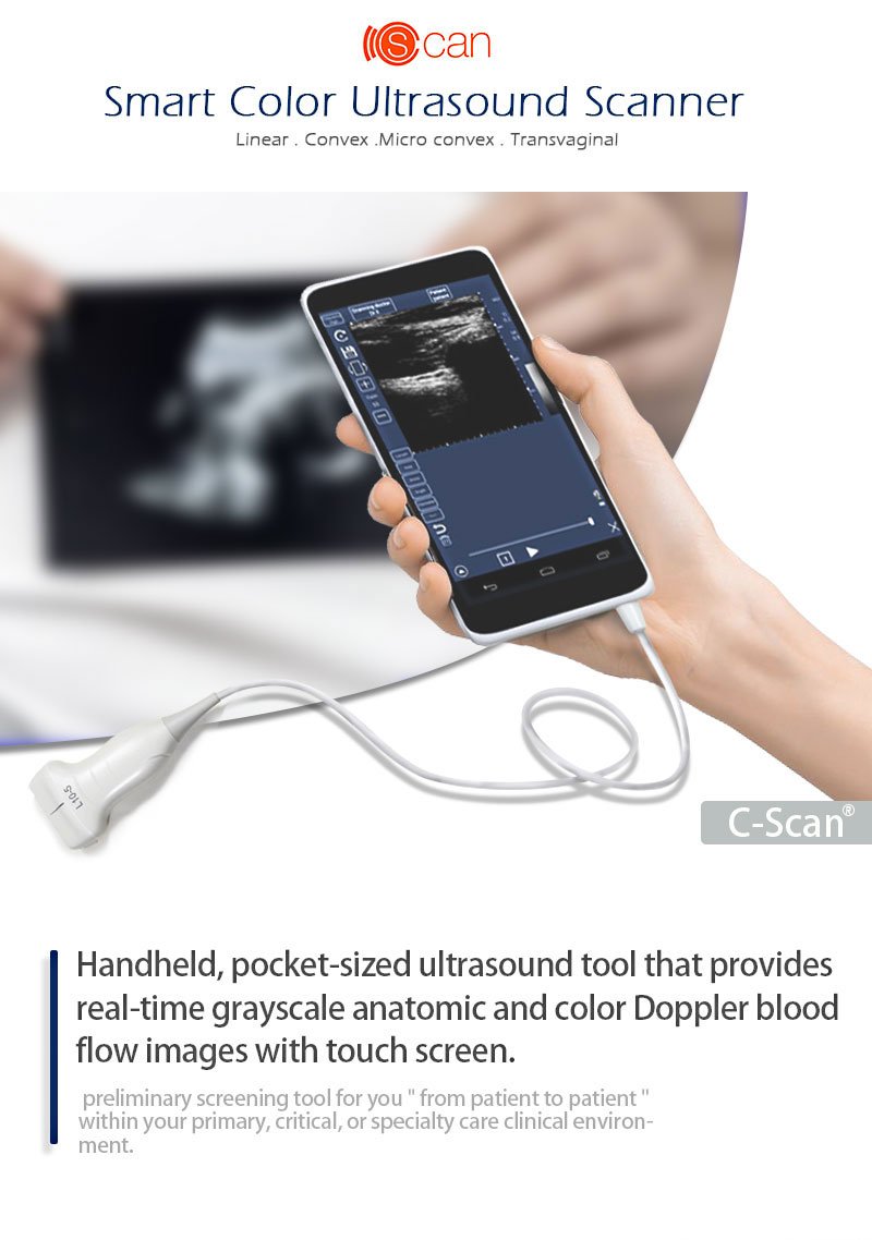 CScan® Android Ultrasound Scanner