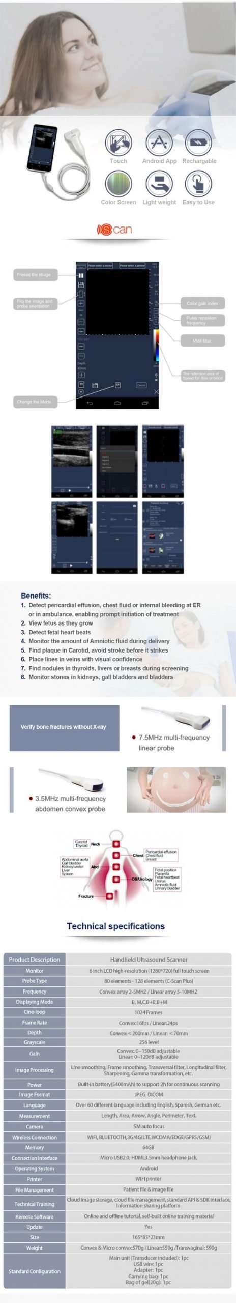 CScan® Android Ultrasound Scanner