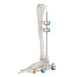 orthopedic-_0005s_0002_7100-19