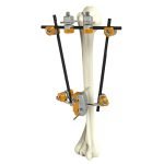 orthopedic-_0005s_0021_7100-03|orthopedic-_0005s_0013_7100-11|orthopedic-_0005s_0014_7100-10|orthopedic-_0005s_0015_7100-09|orthopedic-_0005s_0016_7100-08|orthopedic-_0005s_0017_7100-07|orthopedic-_0005s_0018_7100-06|orthopedic-_0005s_0019_7100-05|orthopedic-_0005s_0020_7100-04
