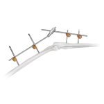 Elbow Joint External Fixator