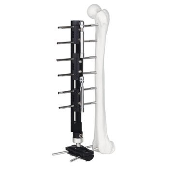 Bone Lengthening External Fixator - Type C